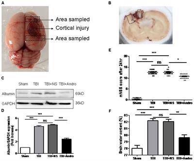 Andrographolide Alleviates Acute Brain Injury in a Rat Model of Traumatic Brain Injury: Possible Involvement of Inflammatory Signaling